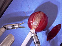内視鏡下手術用の医療機器でブドウの薄皮を縫合してみた動画。ダ・ヴィンチ外科手術システム
