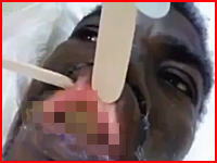 ウジウジ動画(°_°)口の中に蛆虫がいっぱい湧いてしまった男性のビデオ。