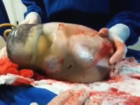 生命の神秘。赤ちゃんが羊膜に包まれたまま出てきた！とても珍しい出産ビデオ。