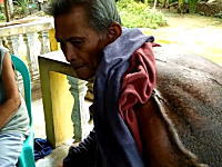 フィリピンで背中に驚くほど巨大な腫瘍を背負った老人が発見される。