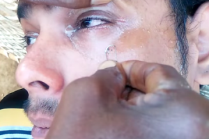 これマジ！？インドの眼球クリーニングが怖すぎる動画。施術道具はクリップだし。