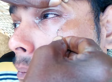 これマジ！？インドの眼球クリーニングが怖すぎる動画。施術道具はクリップだし。