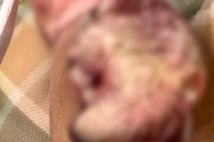 【札幌】マムシに噛まれた男性の腕、とんでもない事になる動画（注意）