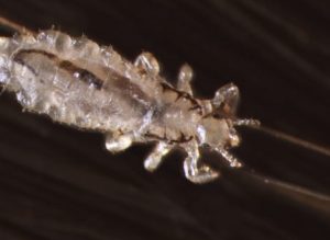 ヒトの陰部や頭皮に寄生する毛シラミをズームで見るとなかなか綺麗な生き物だった。