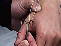指にガッツリ刺さってしまった釣り針を抜く方法((((；ﾟДﾟ))))これはぎゃあああ！
